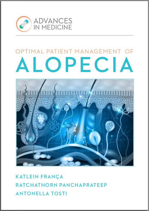 Management of Alopecia